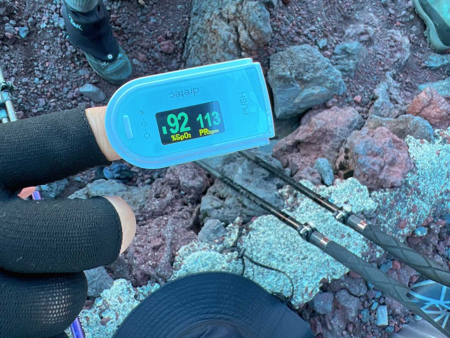 オキシメーターで酸素濃度を測定